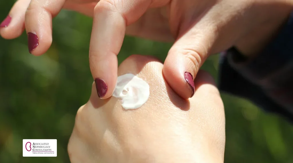 Moisturizing cream being rubbed into the back of a hand to soothe dry, itchy skin